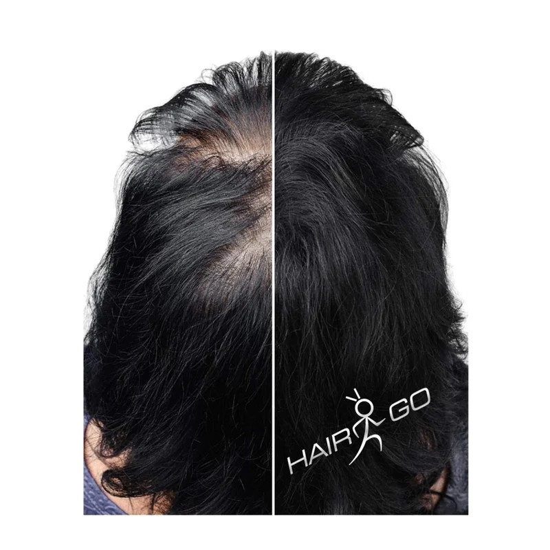 ibspot-25077228