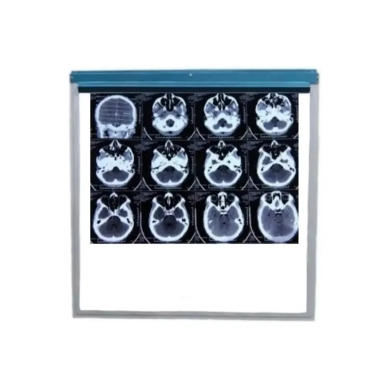 ibspot-36765664